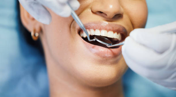 Best Emergency Dental Extractions in Highland, MD